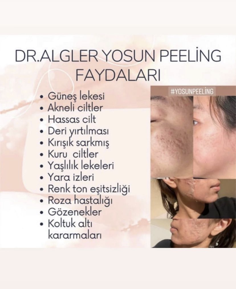Dr.Algler%20Yosun%20Peeling%20